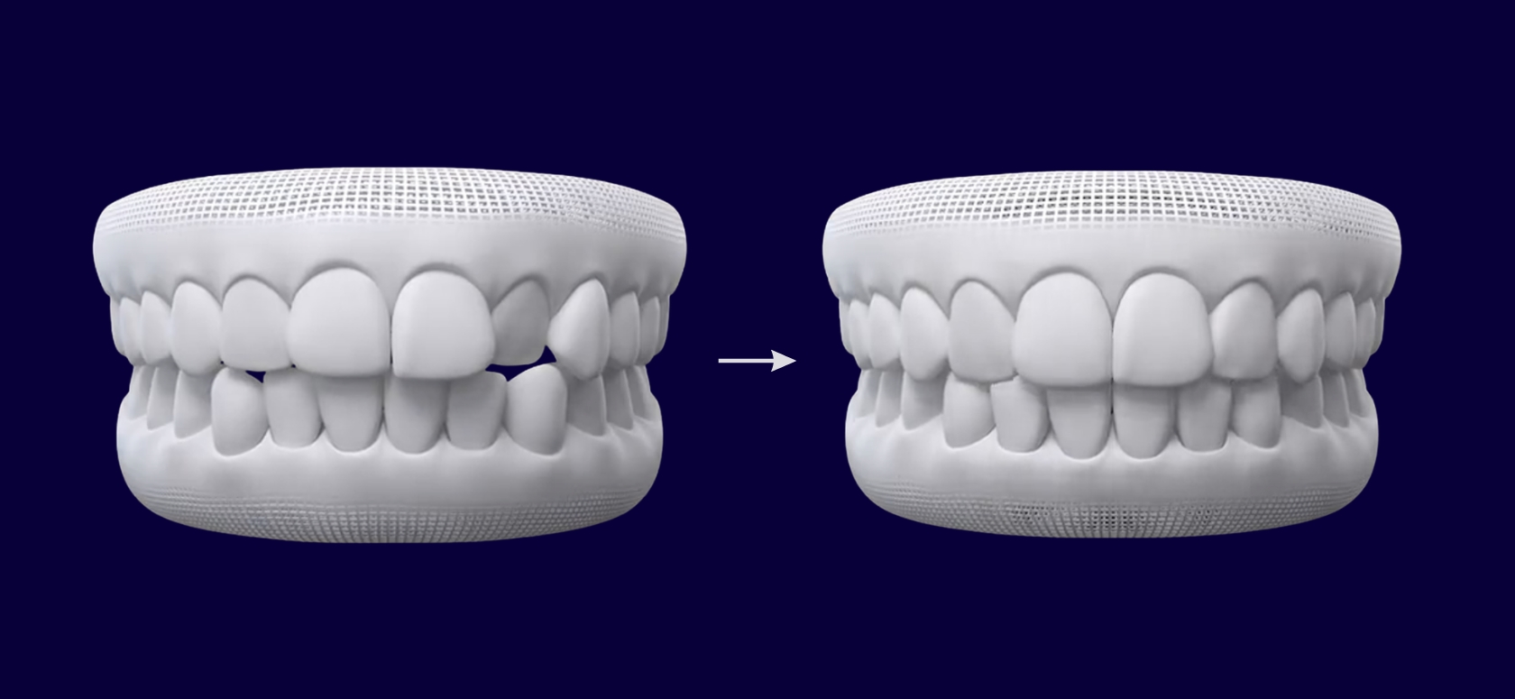 metakinisi palia therapeia